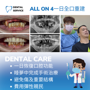 All on 4全口重建01