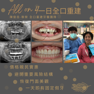 All on 4全口重建03