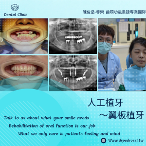 All on 4全口重建