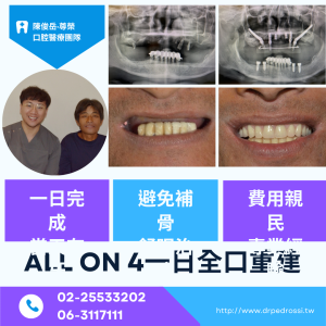 All on 4全口重建