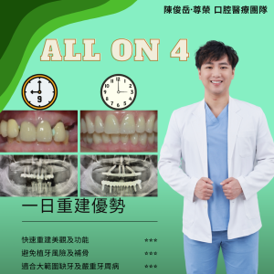 All on 4全口重建