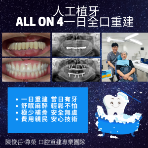 All on 4全口重建