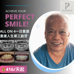 All on 4全口重建