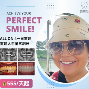 All on 4全口重建