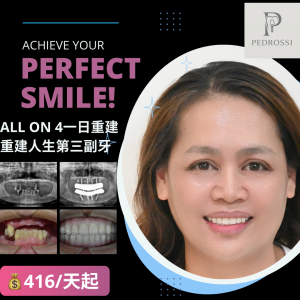 All on 4全口重建