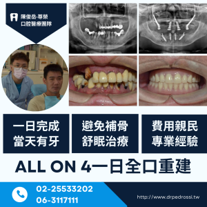 All on 4全口重建