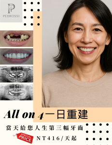 All on 4全口重建