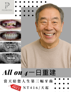 All on 4全口重建