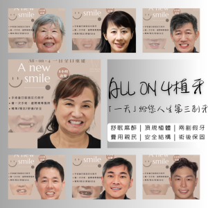 All on 4全口重建