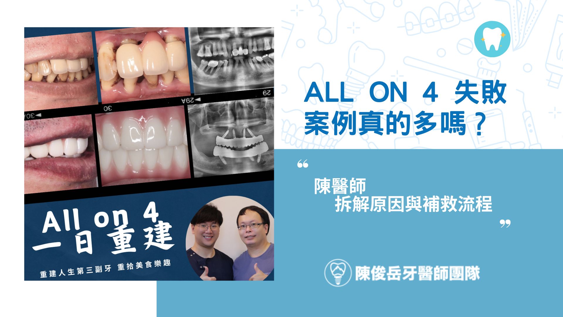 all on 4 案例