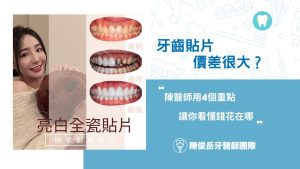 牙齒貼片